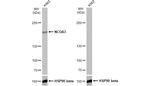 SRC3 Antibody in Western Blot (WB)