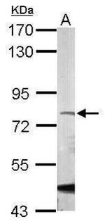 PIAS1 Antibody in Western Blot (WB)
