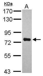 PIAS1 Antibody in Western Blot (WB)