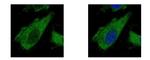 AIP Polyclonal Antibody