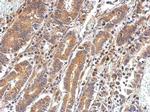 PAPSS2 Polyclonal Antibody
