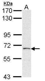 PAPSS2 Antibody in Western Blot (WB)