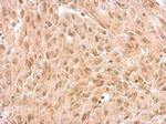 NR1D1 Antibody in Immunohistochemistry (Paraffin) (IHC (P))