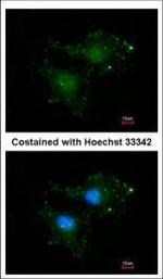 Bcl-B Antibody in Immunocytochemistry (ICC/IF)