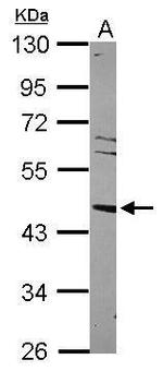 LXR alpha Polyclonal Antibody