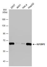 IGF2BP2 Polyclonal Antibody