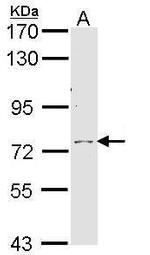 Calpain 10 Polyclonal Antibody
