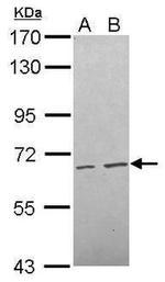 FBXW11 Antibody in Western Blot (WB)