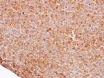 FBXW11 Antibody in Immunohistochemistry (Paraffin) (IHC (P))