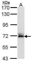 FBXW11 Antibody in Western Blot (WB)