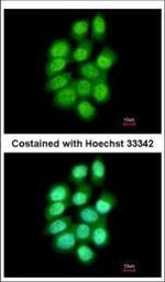 PADI4 Polyclonal Antibody