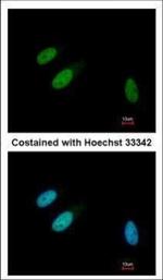 TRIB3 Antibody in Immunocytochemistry (ICC/IF)