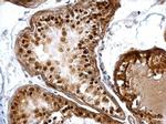 DUSP16 Antibody in Immunohistochemistry (Paraffin) (IHC (P))