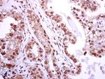 BRIP1 Antibody in Immunohistochemistry (Paraffin) (IHC (P))