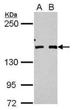 BRIP1 Antibody in Western Blot (WB)