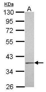 IGBP1 Polyclonal Antibody