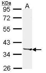 Alcohol Dehydrogenase 1B Polyclonal Antibody