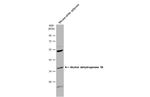 Alcohol Dehydrogenase 1B Antibody in Western Blot (WB)