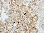 COMT Polyclonal Antibody