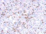 CYP27A1 Polyclonal Antibody