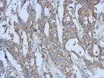 EphA3 Polyclonal Antibody