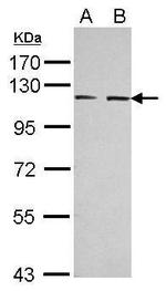 EphA3 Antibody in Western Blot (WB)