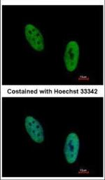 EWSR1 Antibody in Immunocytochemistry (ICC/IF)