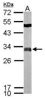 FHL2 Antibody in Western Blot (WB)