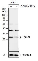 GCLM Antibody in Western Blot (WB)