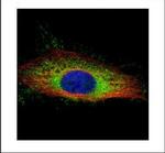 Gelsolin Polyclonal Antibody