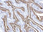 Gelsolin Antibody in Immunohistochemistry (Paraffin) (IHC (P))