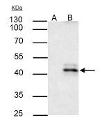 HLA-A Polyclonal Antibody
