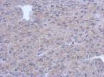 PNMT Polyclonal Antibody