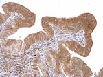 ROBO1 Antibody in Immunohistochemistry (Paraffin) (IHC (P))