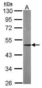 SMARCB1 Antibody in Western Blot (WB)