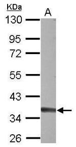 TREX1 Antibody in Western Blot (WB)