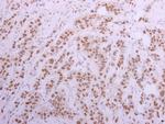 CUGBP1 Polyclonal Antibody