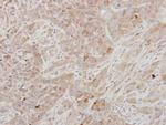 Prolactin Polyclonal Antibody