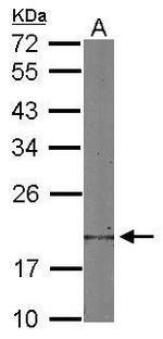 Destrin Antibody in Western Blot (WB)