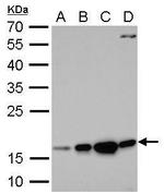 Destrin Polyclonal Antibody