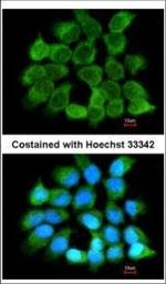 NNT1 Polyclonal Antibody