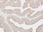 NNT1 Antibody in Immunohistochemistry (Paraffin) (IHC (P))