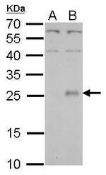 NNT1 Antibody in Western Blot (WB)