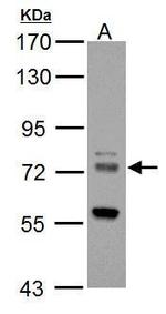 ZDHHC17 Polyclonal Antibody
