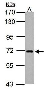 ZDHHC17 Antibody in Western Blot (WB)