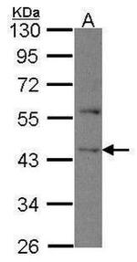 DAPK2 Antibody in Western Blot (WB)
