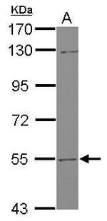 UGT2B7 Polyclonal Antibody