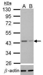 TDP-43 Antibody in Western Blot (WB)