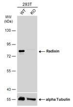 Radixin Antibody in Western Blot (WB)