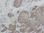 SUFU Antibody in Immunohistochemistry (Paraffin) (IHC (P))